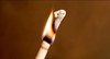 KIT BOUGIES OREILLE X3 4